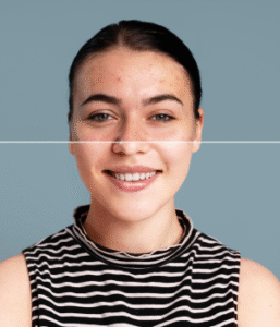 clareamento facial dra juliana camargo