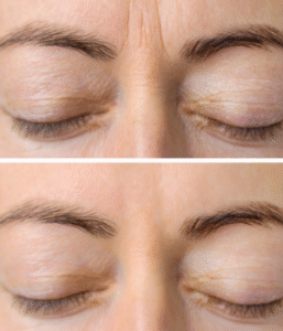 marcas de expressão dra juliana camargo