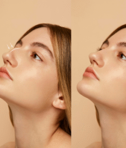 nariz dra juliana camargo